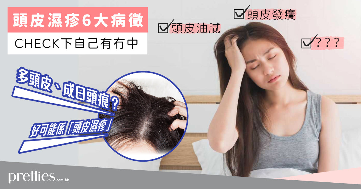 【Flaking and itchy？】It might be Scalp Eczema! 6 symptoms to check on!