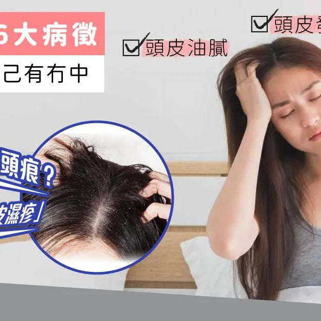 Flaking-and-itchy-It-might-be-Scalp-Eczema-6-symptoms-to-check-on Pretties.com.hk